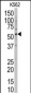 POLG2 Antibody (Center)